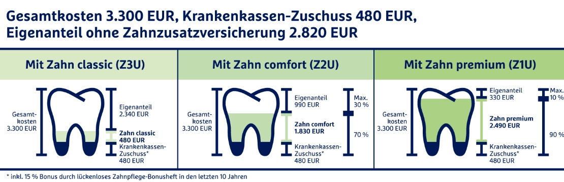 Die Grafik zeigt die drei Tarifvarianten der Zahnzusatzversicherung der R+V.