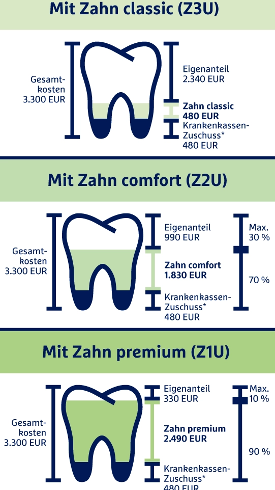 Die Grafik zeigt die drei Tarifvarianten der Zahnzusatzversicherung der R+V.