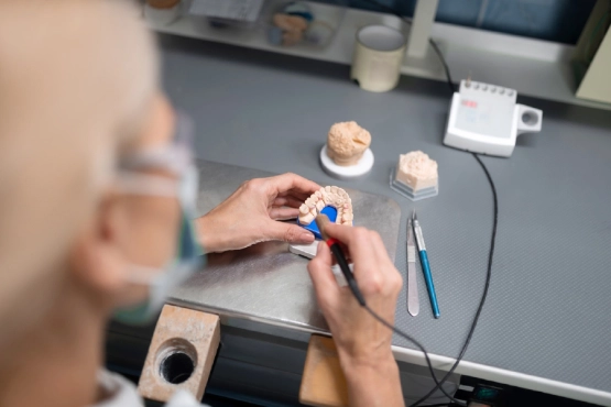 Eine Zahnärztin arbeitet an einem Gebissabdruck für Veneers 