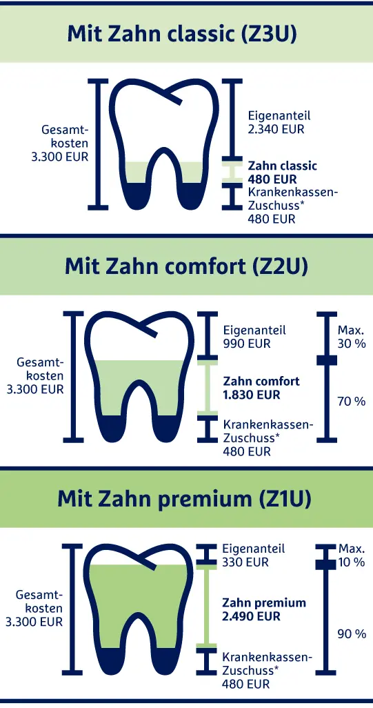 Die Grafik zeigt die drei Tarifvarianten der Zahnzusatzversicherung der R+V.