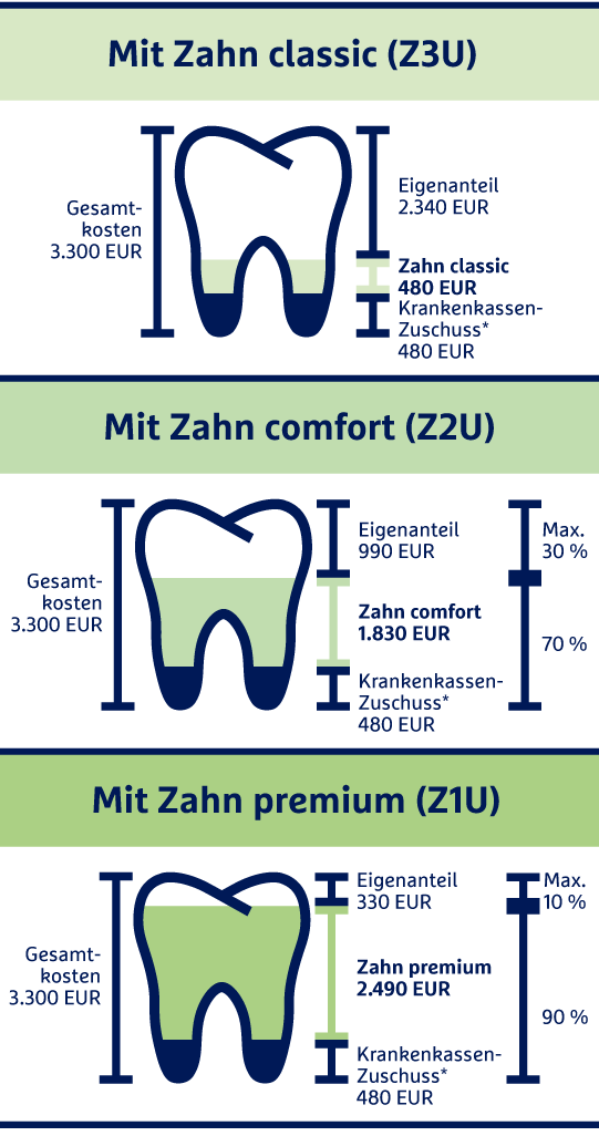 Beispielrechnung für ein Implantat: Gesamtkosten 3.300 EUR, Krankenkassen-Zuschuss 480 EUR, Eigenanteil ohne Zahnzusatzversicherung 2.820 EUR im Tarif Zahn classic beträgt der Eigenanteil nur noch 2.340 EUR, im Tarif Zahn comfort beträgt der Eigenanteil nur noch 990 EUR, im Tarif  Zahn premium beiträgt der Eigenanteil nur noch 330 EUR.