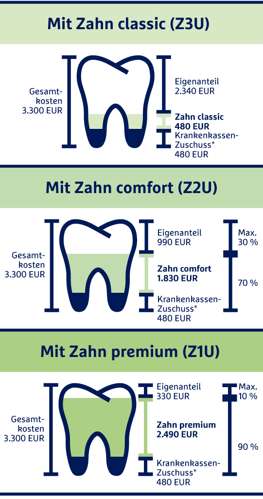 Die Grafik zeigt die drei Tarifvarianten der Zahnzusatzversicherung der R+V.