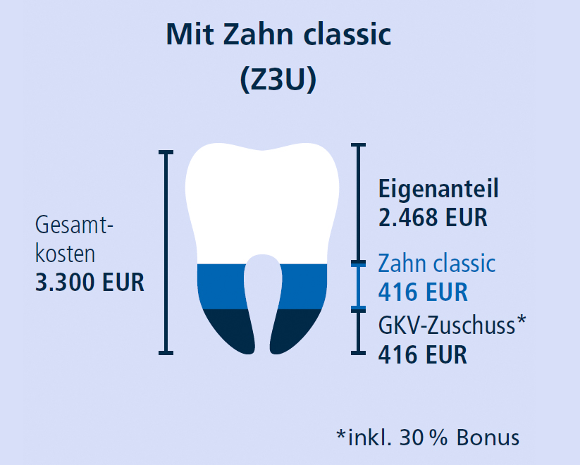 Private ZahnZusatzversicherung der R+V Zahnzusatz
